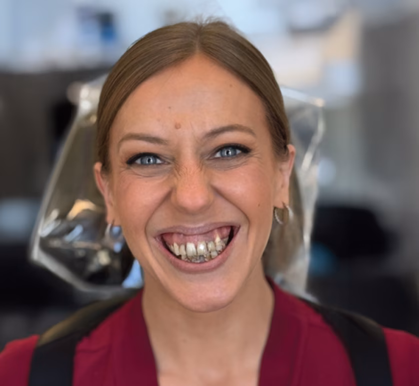 Smile before dental treatment